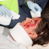 a lady with cuts on her face wearing a neck brace